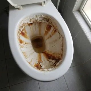 Toilette mit dicker brauner Kalkkruste vor der Anwendung